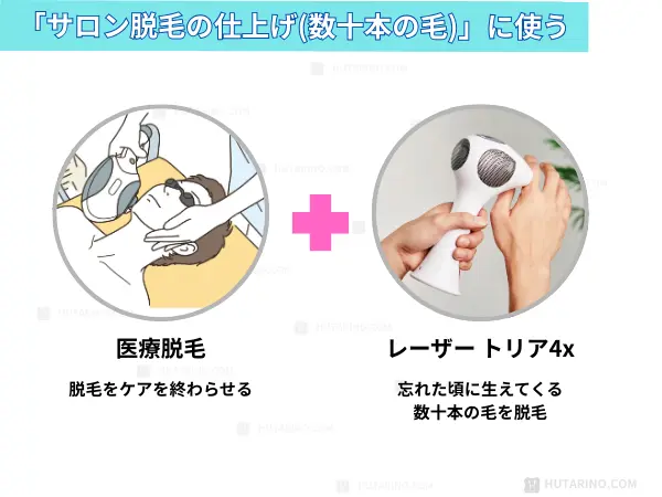 医療脱毛とトリア4xの組み合わせた使用方法