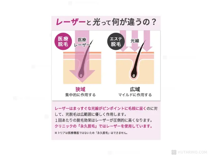 レーザー脱毛器と光脱毛機の違い
