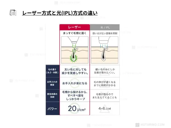 レーザー脱毛と光IPL脱毛との違い