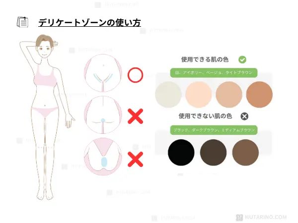 家庭用レーザー脱毛器 tria トリア の使い方 デリケートゾーンの照射方法のイラスト