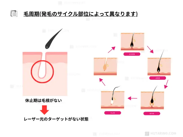 毛周期と脱毛にかかる期間の説明のイラスト
