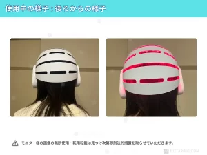 【体験談レビュー・口コミ】CurrentBody Skin LED 頭皮・頭髪ケアデバイスを長期間使用した様子