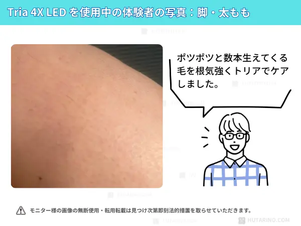 トリア4x を足に使ってみた感想 足の使用シーン