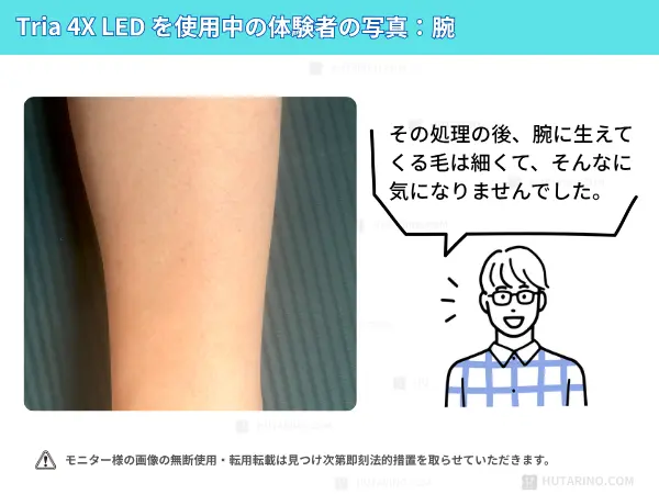 トリア4xを腕に使用してみた感想　腕の使用シーン