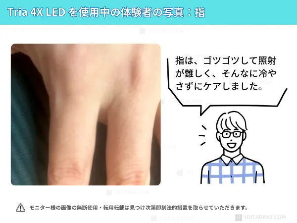 トリア4xを指に使用してみた感想　指の使用シーン